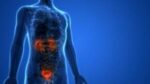 Tumore della prostata, ecco i consigli della Società Italiana di Urologia